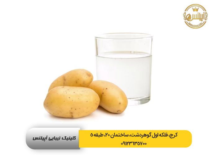 سفید کردن پوست با سیب زمینی 
