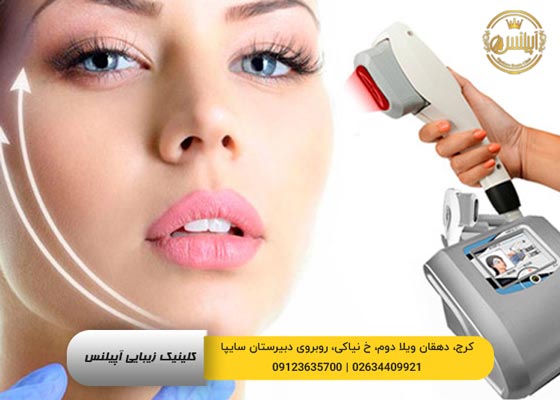 هایفوتراپی لیفت صورت و شقیقه در کرج 