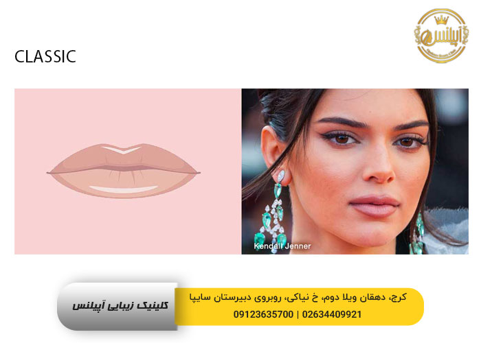 مدل ژل لب کلاسیک در کرج