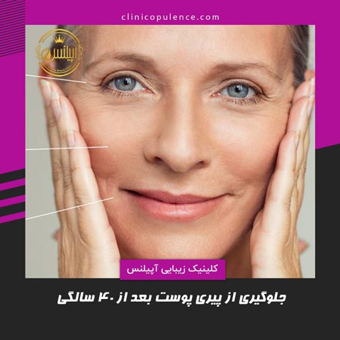 جلوگیری از پیری پوست بالای 40 سالگی