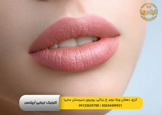 تزریق ژل لب روسی در کرج