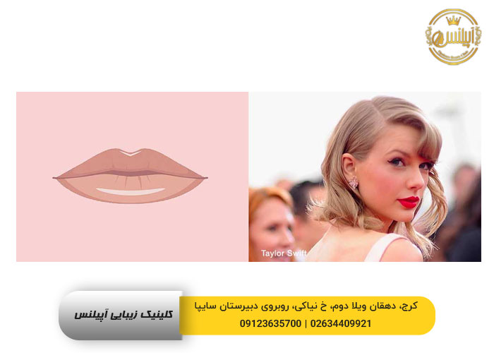 طرح ژل لب جدید در کرج