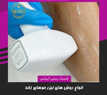 لیزر موهای زائد در کرج