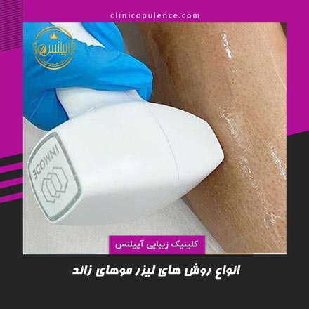 لیزر موهای زائد در کرج