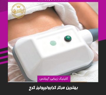 کرایولیپولیز کرج