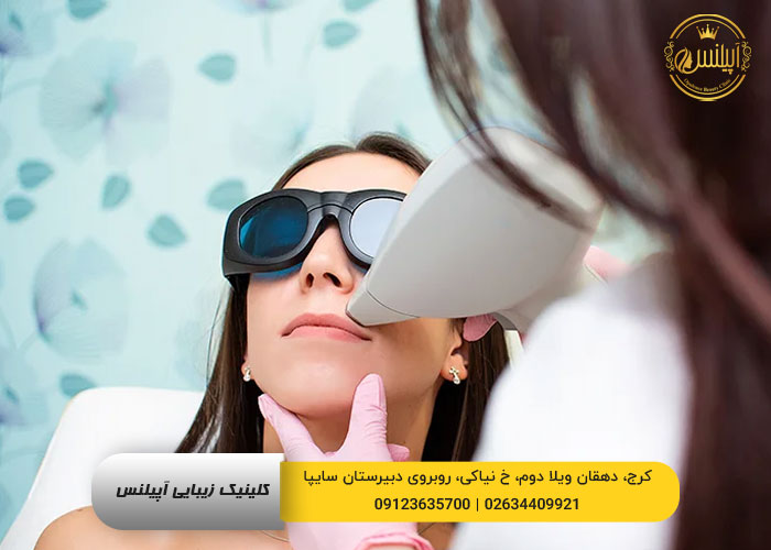 لیزر موی زائد در کرج