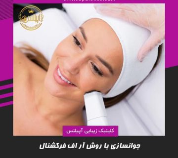 آر اف فرکشنال در کرج
