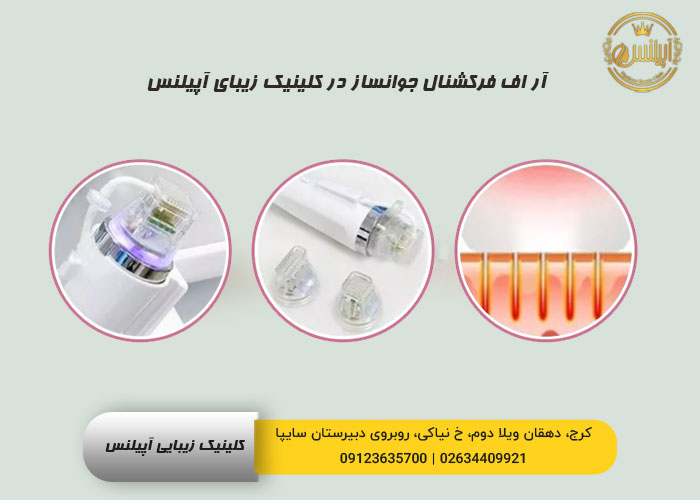 آر اف فرکشنال