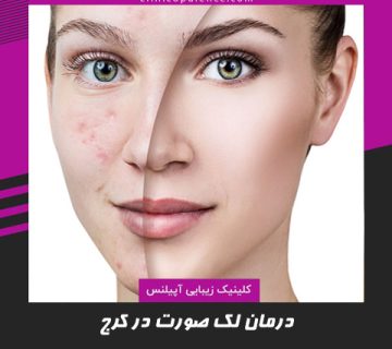 درمان لک صورت در کرج