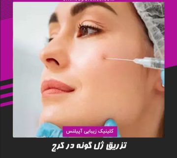 تزریق ژل گونه در کرج