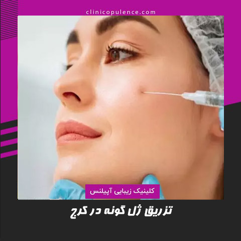 تزریق ژل گونه در کرج
