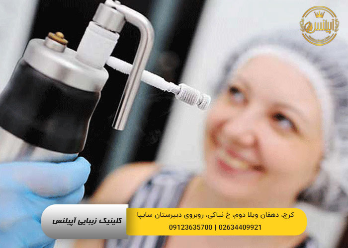 کرایوتراپی کرج