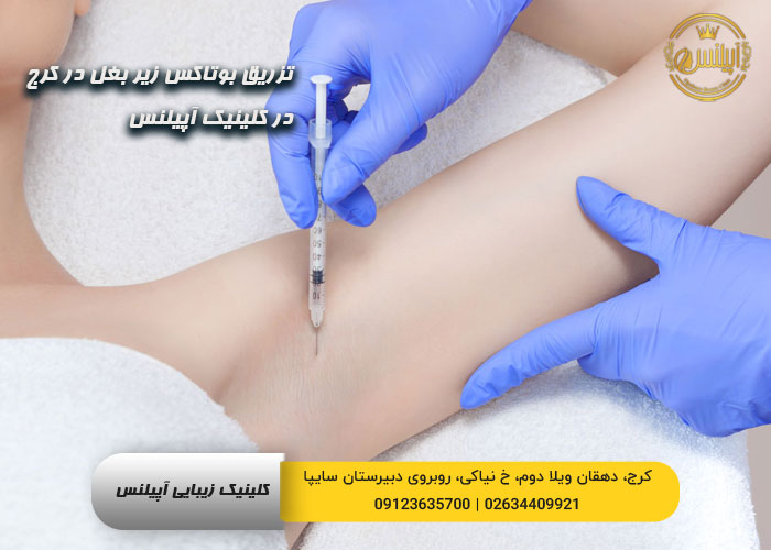بوتاکس زیر بغل کرج
