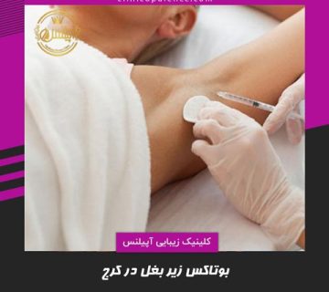 بوتاکس زیر بغل در کرج