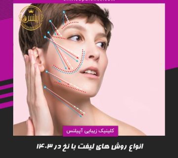 روش های لیفت با نخ در کرج کاگ مونو اسکرو
