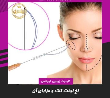 نخ لیفت کاگ