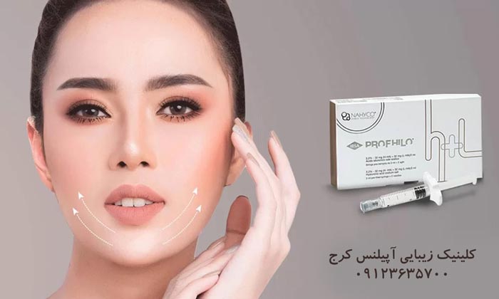 تزریق ژل پروفایلو 