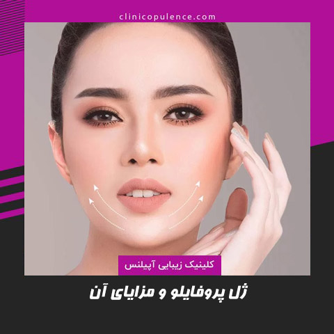ژل پروفایلو در کرج و مزایای آن