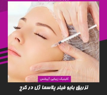 تزریق بایوفیلر پلاسما ژل در کرج کلینیک آپیلنس
