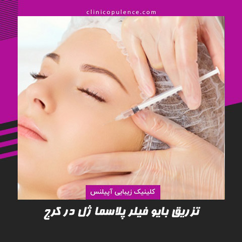 تزریق بایوفیلر پلاسما ژل در کرج کلینیک آپیلنس