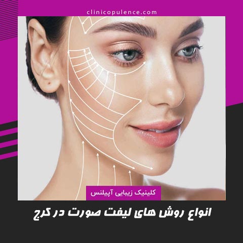 لیفت صورت در کرج