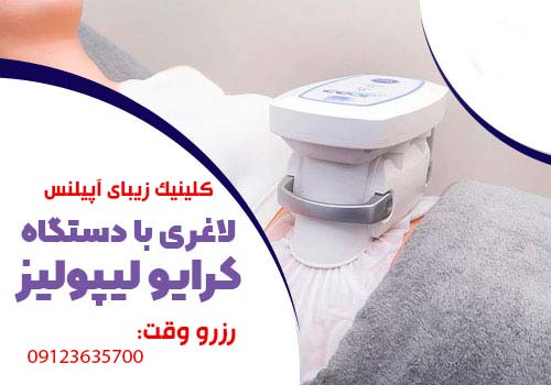 رزرو وقت کرایولیپولیز در کرج