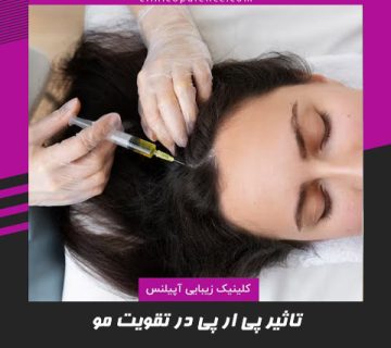 تزریق prp