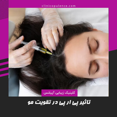 تزریق prp
