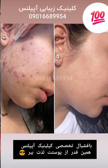 فیشیال کرج صورت