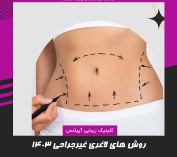 لاغری غیرجراحی در کرج