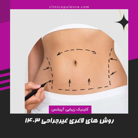 لاغری غیرجراحی در کرج