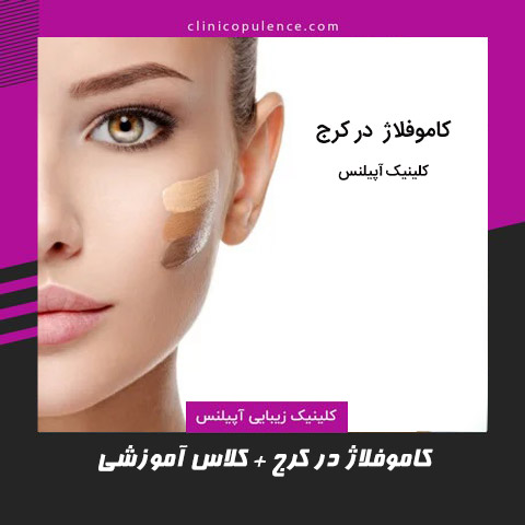 کاموفلاژ در کرج