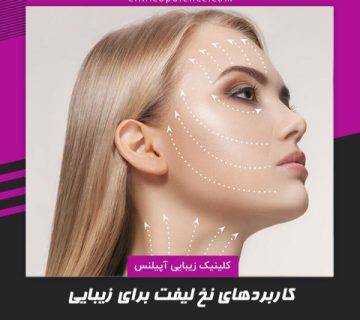 کاربردهای نخ لیفت برای زیبایی صورت و شقیقه