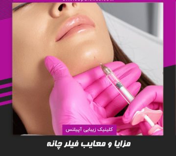 ژل چانه در کرج