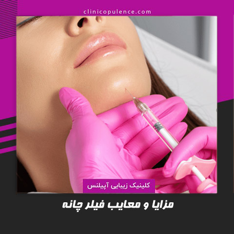 ژل چانه در کرج