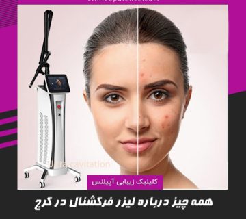 لیزر co2 فرکشنال