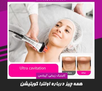 اولترا کویتیشن لاغری در کرج تخفیف