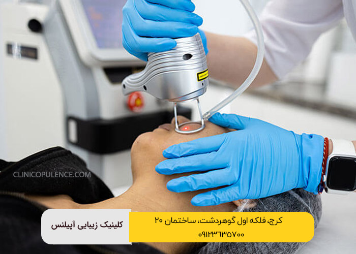 لیزر فرکشنال برای جوانسازی