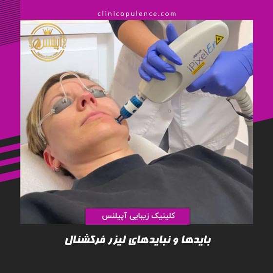 نکات لیزر فرکشنال در کرج