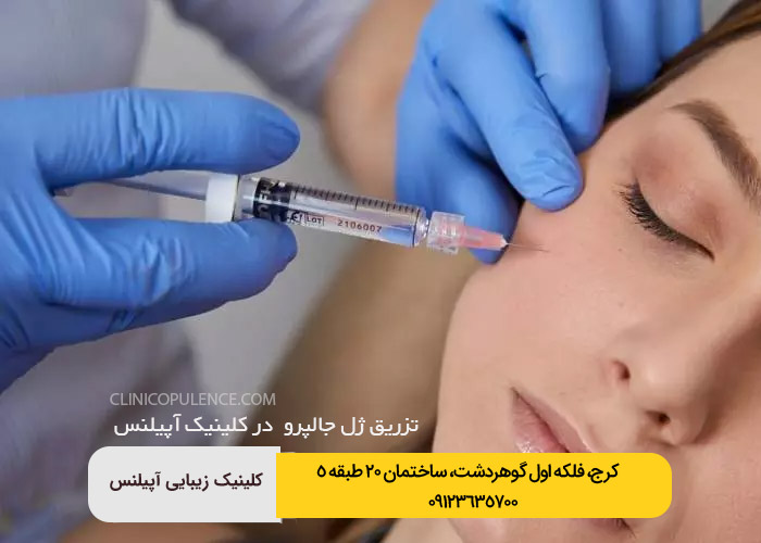 تزریق ژل جالپرو زیر چشم جوانسازی در کرج