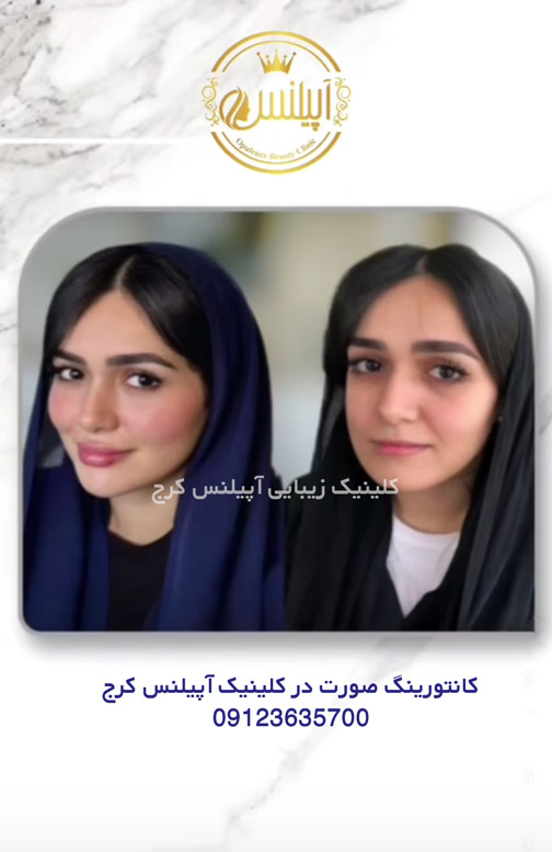 کانتورینگ کرج