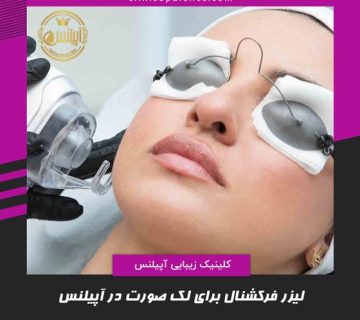 لیزر فرکشنال co2