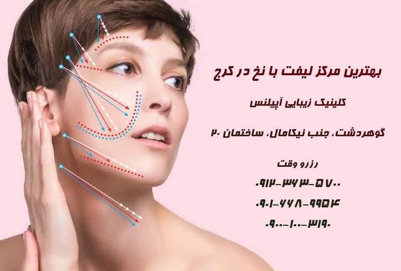 لیفت با نخ در گوهردشت عظیمیه طالقانی گلشهر دهقان ویلا کرج