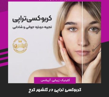 کربوکسی تراپی گلشهر دهقان ویلا کرج