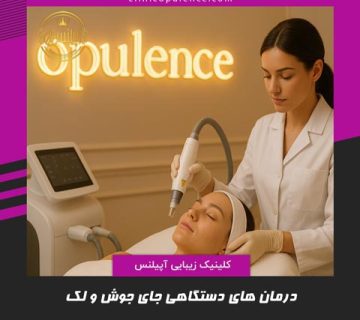 درمان جای جوش و لک با دستگاه در کرج