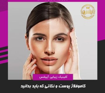 کاموفلاژ پوست تهران کرج قزوین