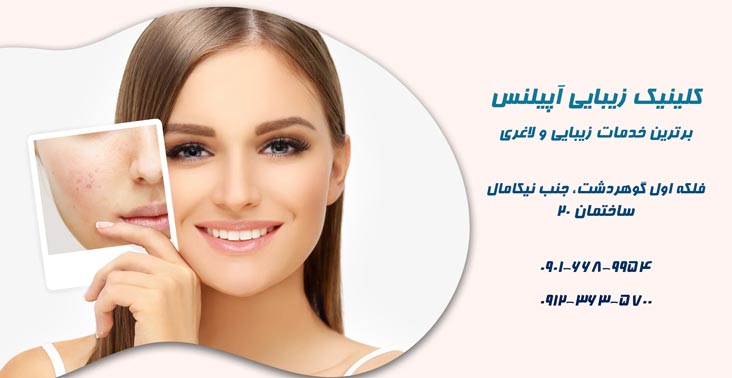 کلینیک زیبایی کرج سفید شدن روشن شدن پوست 