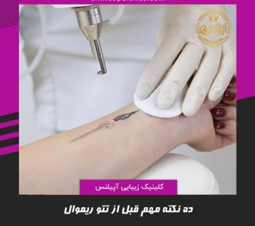 نکات قبل از پاک کردن تتو در تهران قزوین کرج هشتگرد