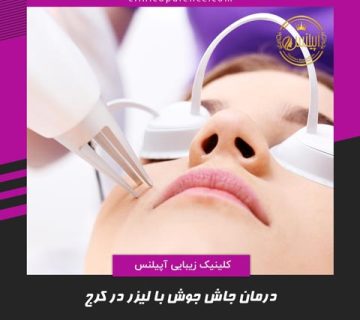 لیزر جای جوش کرج تهران co2