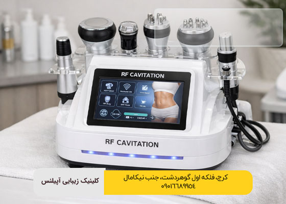آر اف کویتیشن در کرج